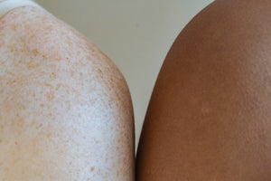 Befreie deine Haut von Sonnenflecken – mit der Kraft des Arganöls!